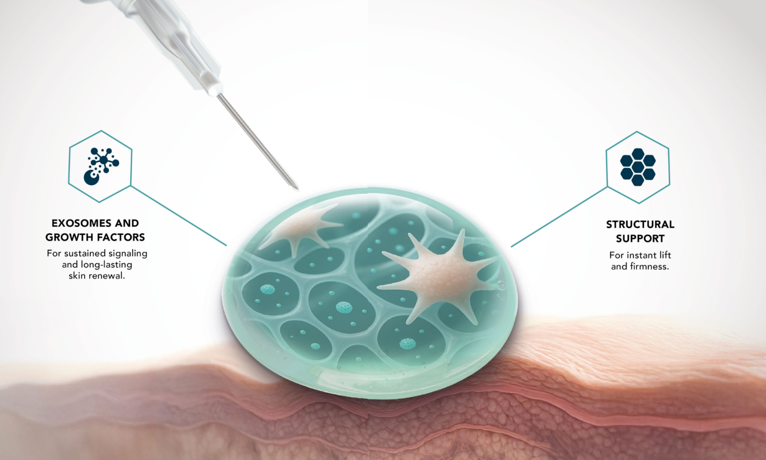 The First Injectable Exosome Bioimplant — A New Add-on for MCT Exosome ...