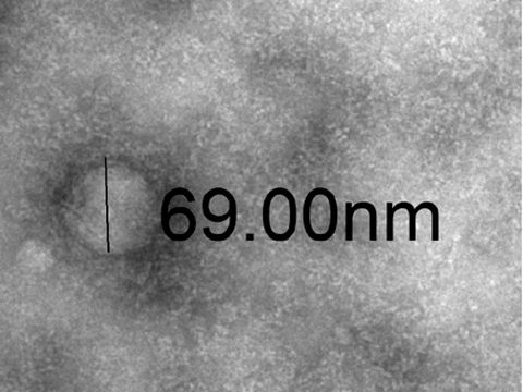 Transmission electron microscopy image of an MCT Exosome, 69.00 nm