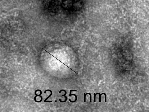 Transmission electron microscopy image of an MCT Exosome, 82.35 nm