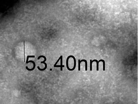 Transmission electron microscopy image of an MCT Exosome, 53.40 nm