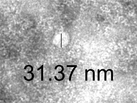 Transmission electron microscopy image of an MCT Exosome, 31.37 nm