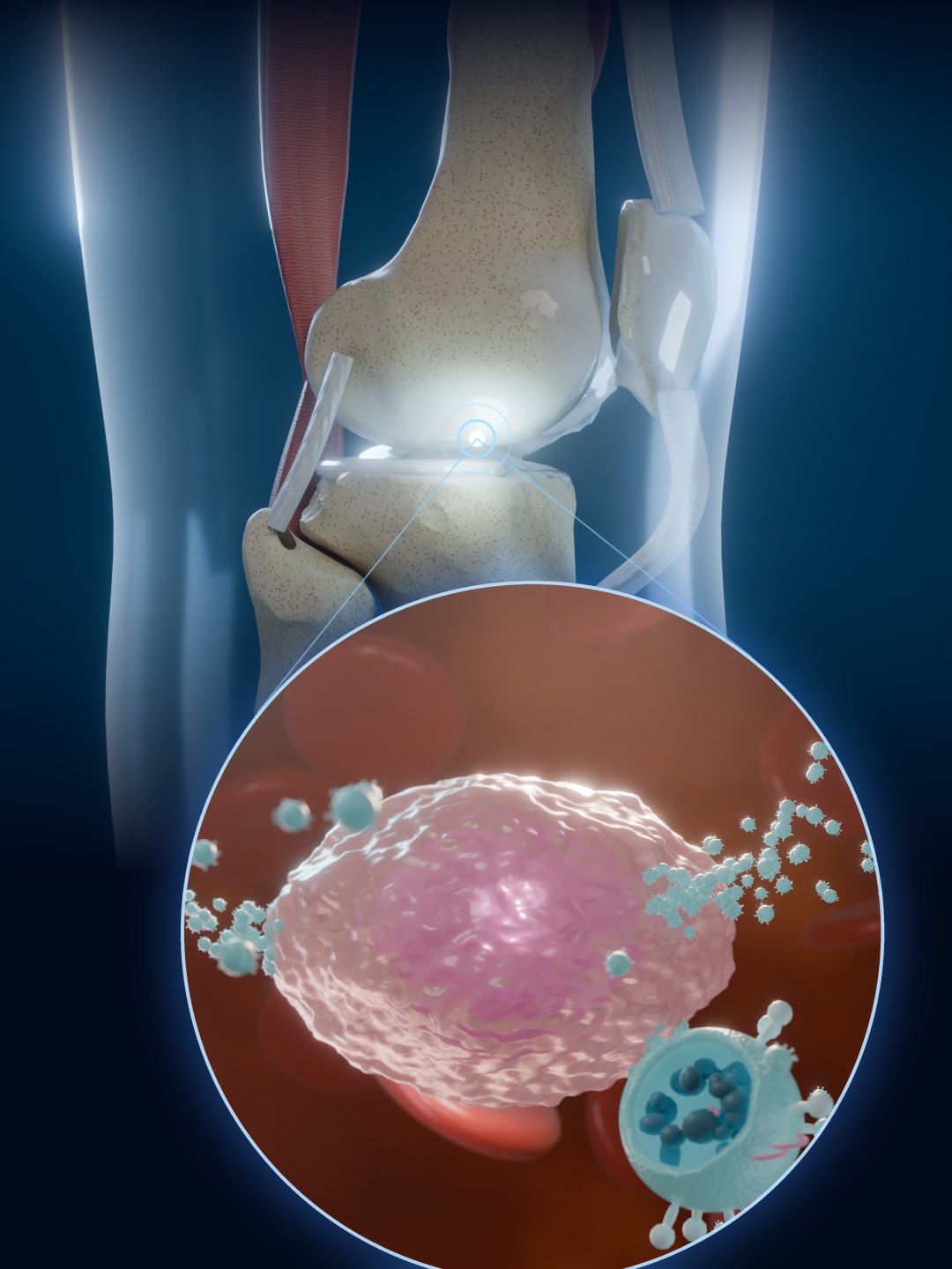 Knee joint with a magnified view of a platelet releasing exosomes by exocytosis
