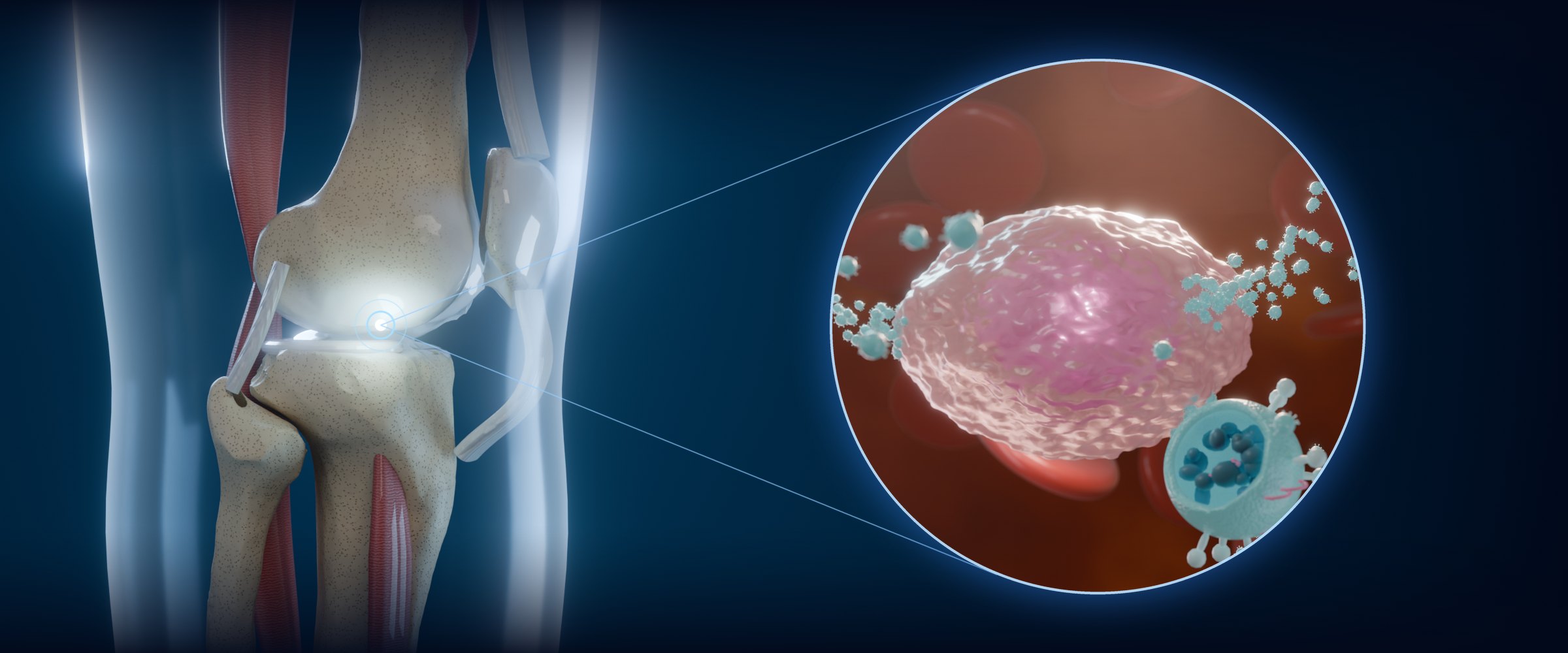 Knee joint with a magnified view of a platelet releasing exosomes by exocytosis